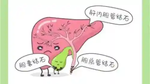 胆结石早餐“妙方”：三类食物巧克结石，重铸胆囊健康曙光乍现？